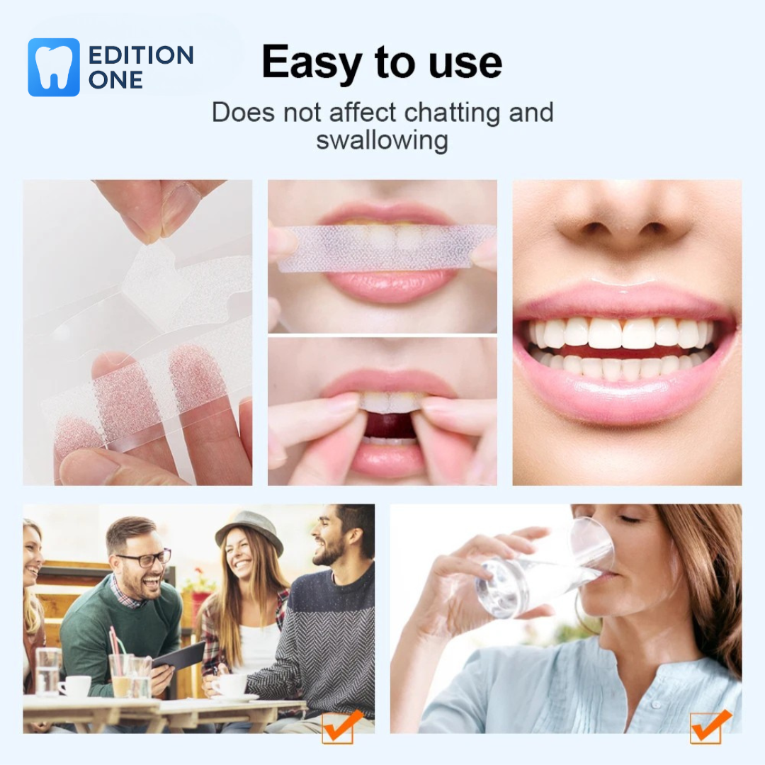 Whitening Strips